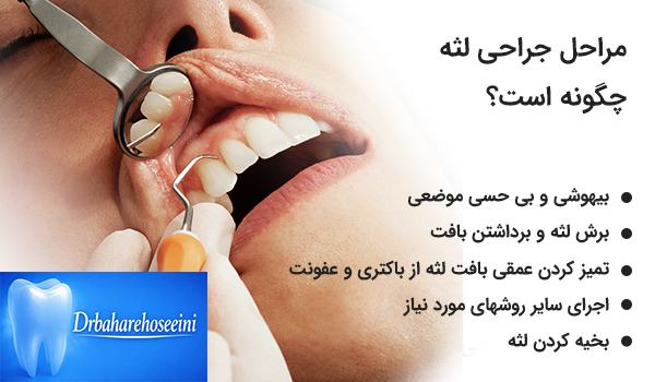 بهترین متخصص لثه در کرج