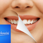 لیزر درمانی در دندانپزشکی( لیزر کم توان و پرتوان دایود)