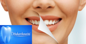لیزر درمانی در دندانپزشکی( لیزر کم توان و پرتوان دایود)