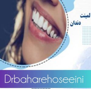 لمینت سرامیکی چیست و در چه مواقعی کاربرد دارد