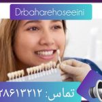 ۱۰ نکته طلایی برای کامپوزیت دندان و مراحل کامپوزیت