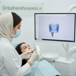 مزایای قالب گیری دیجیتال