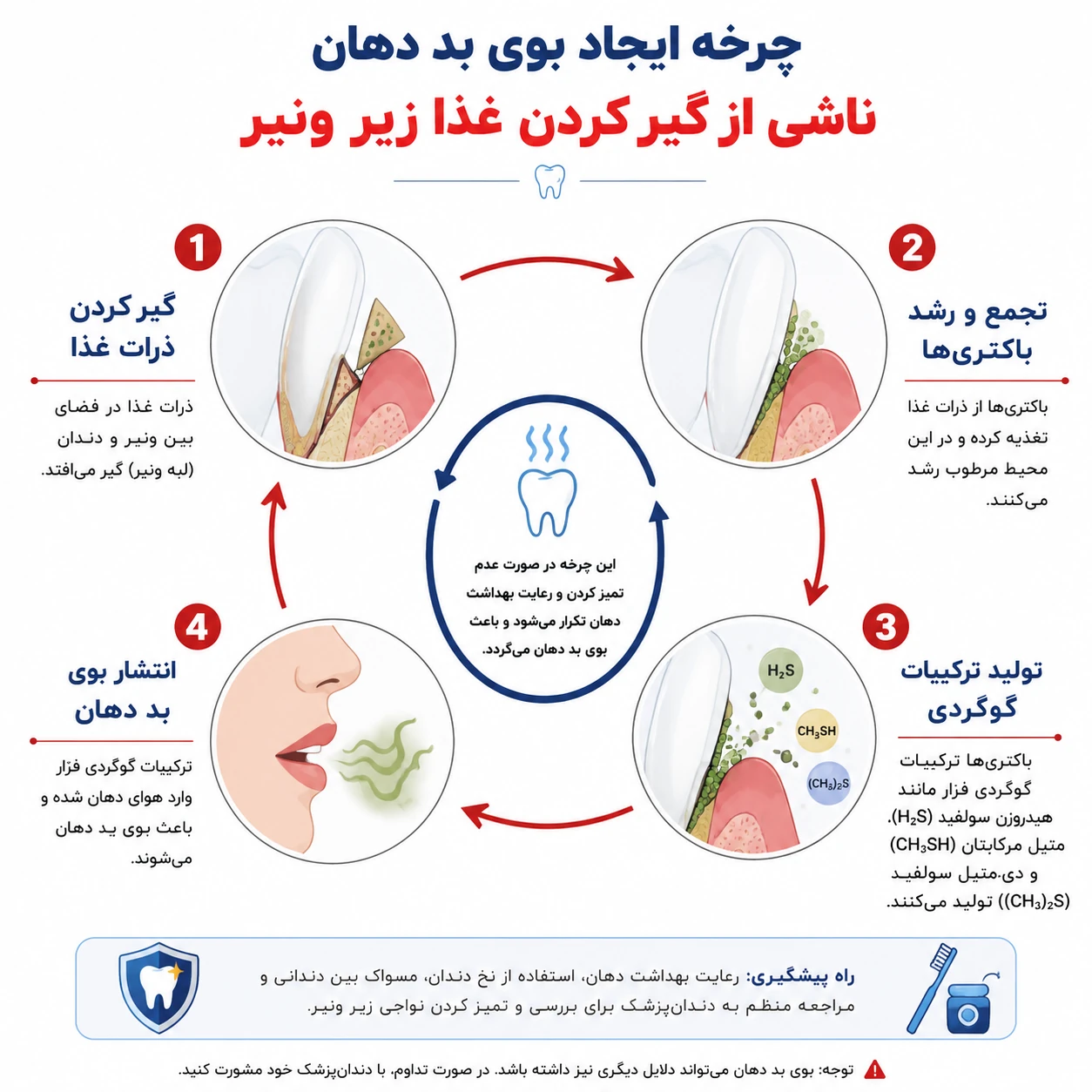 چرخه ایجاد بوی بد دهان ناشی از گیر غذایی زیر روکش دندان